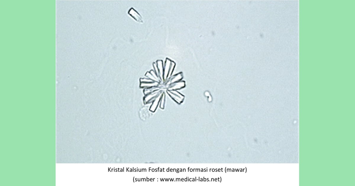 Kalium Fosfat - Kristal kalsium fosfat