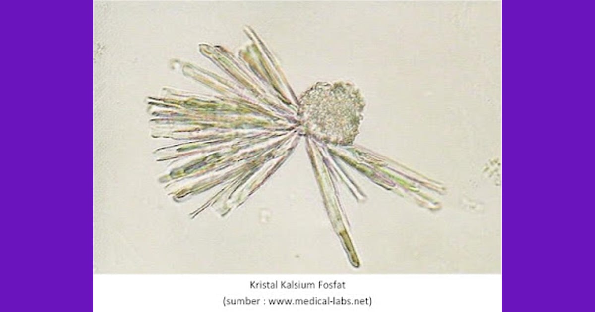 Kalium Fosfat - Kristal kalsium fosfat